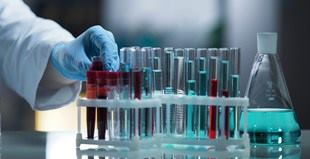 muchos recipientes de muestras para laboratorio