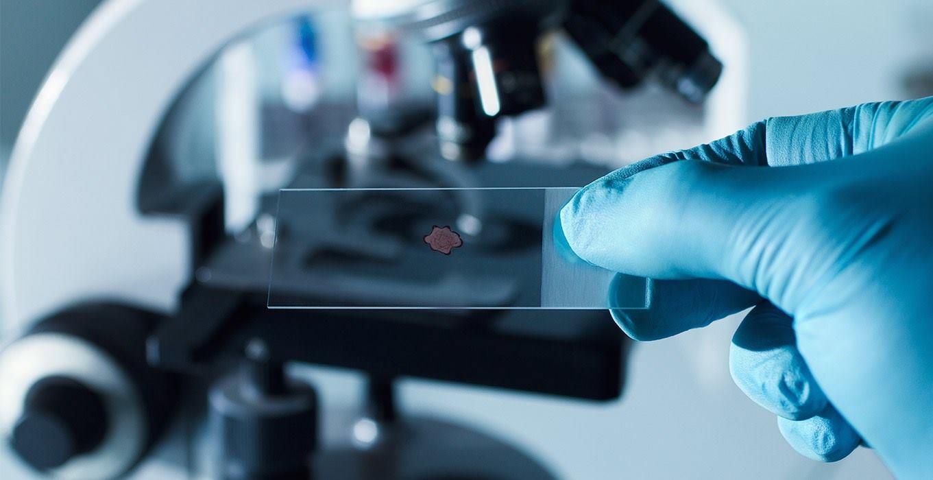 tejido en microscopio 