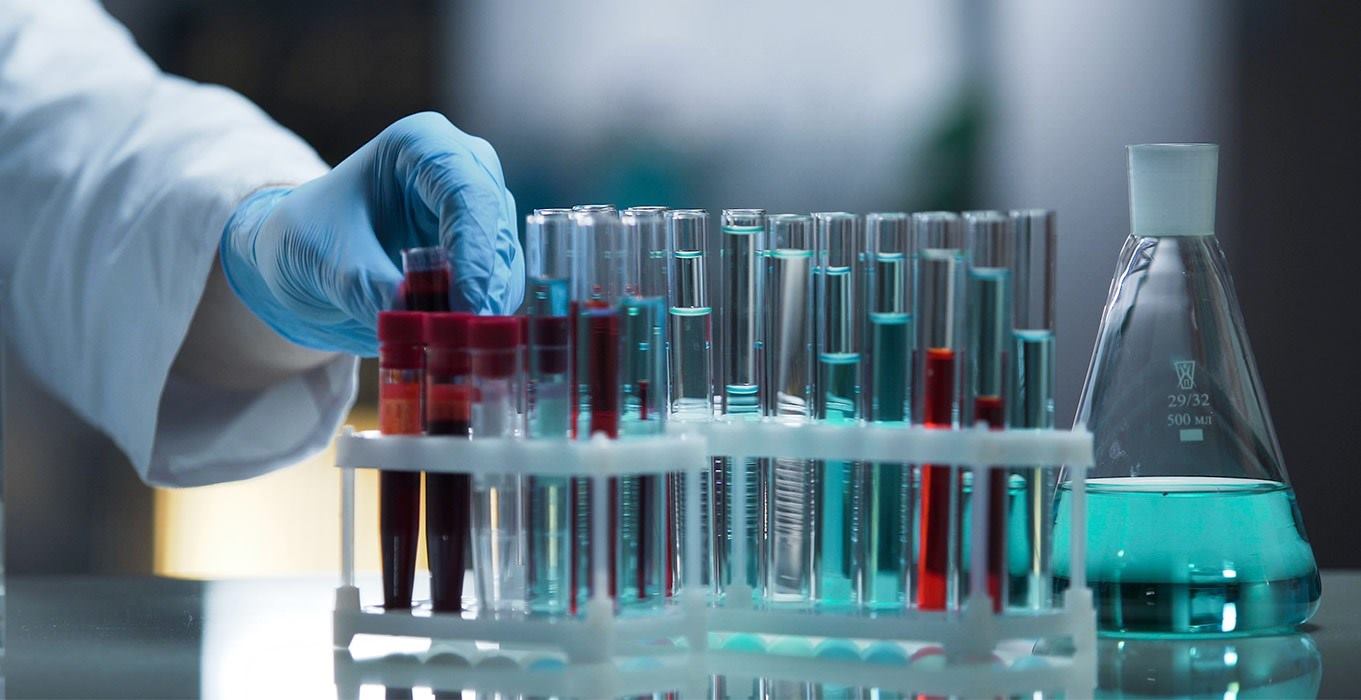 muchos recipientes de muestras para laboratorio